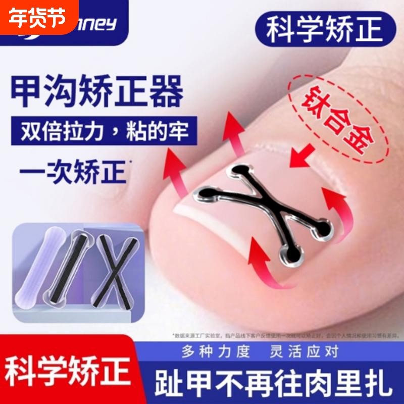 2026新款指甲矫正器甲沟嵌甲纠正贴脚趾头正甲贴片专用修脚工具炎,家庭/个人清洁工具,美甲/修甲套装,淘宝优惠券,粉丝福利购,淘宝优惠卷
