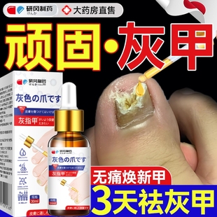 灰指甲专用抑菌液趾甲膏变厚发黄治修甲涂剂冰醋酸男正品 旗舰店