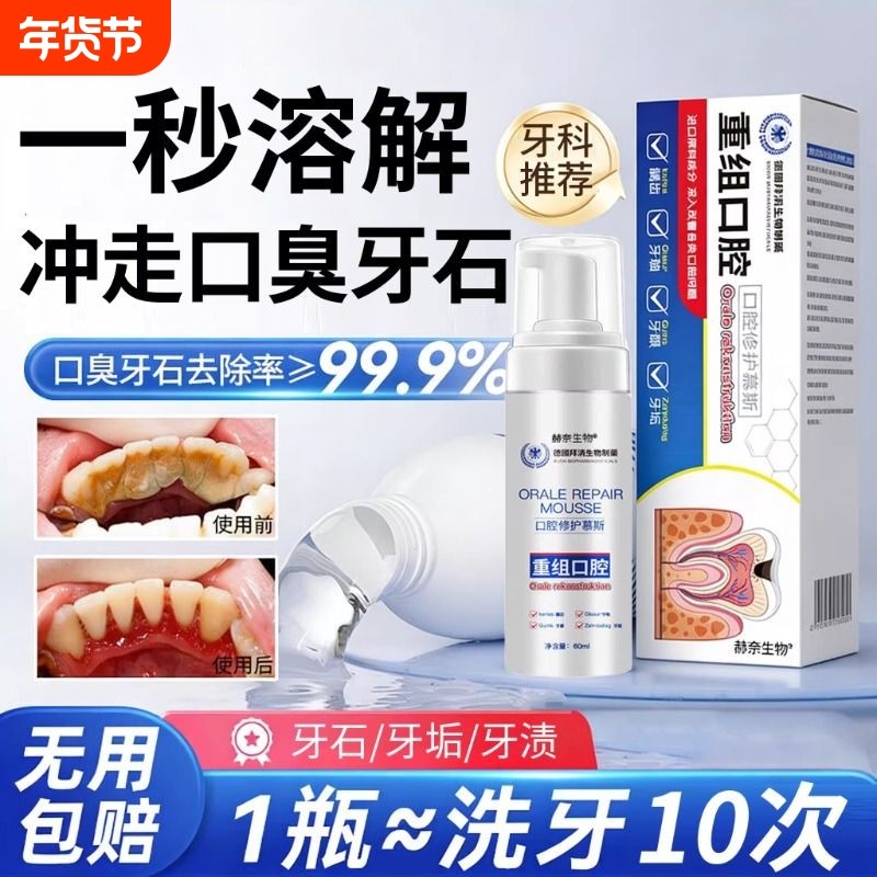牙结石溶解剂便携漱口水杀菌除去口臭炎持久留香口腔牙周清理医用