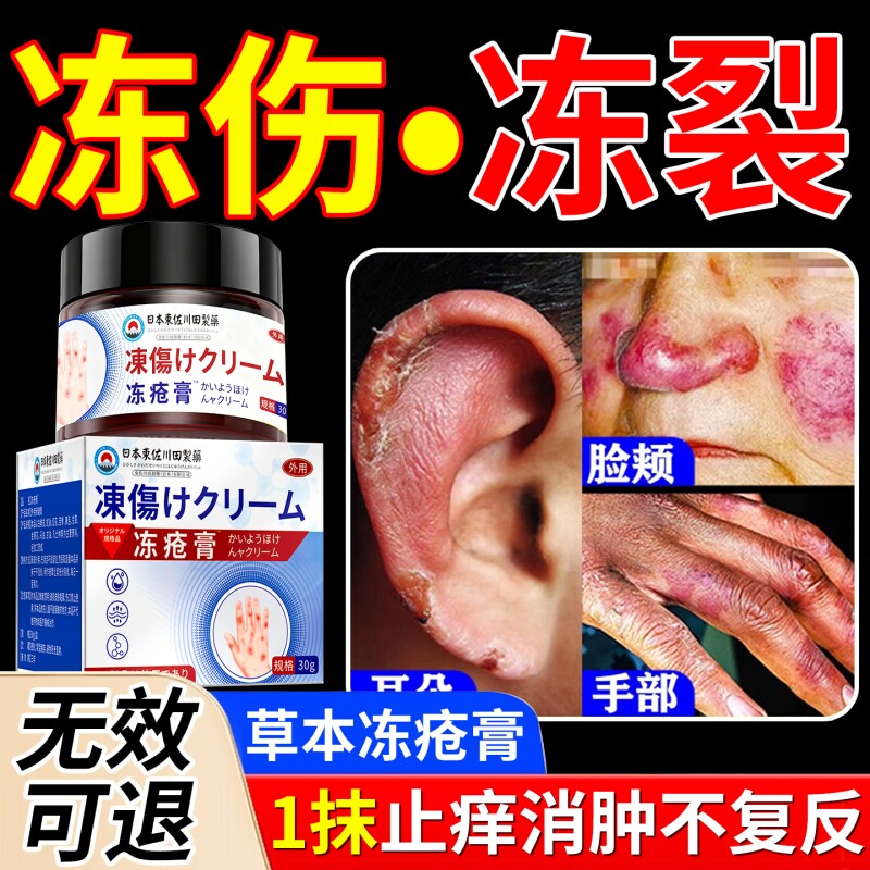 医用冻疮膏止痒冻伤膏正品防冻防裂儿童耳朵脚后跟干裂修复霜手部