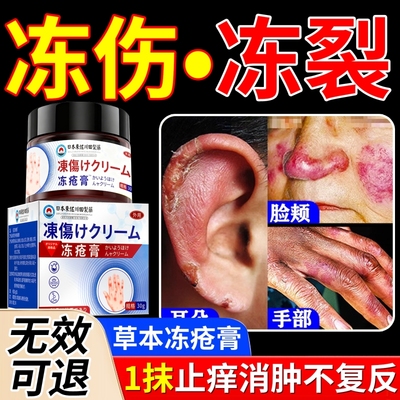 医用冻疮膏止痒冻伤膏正品防冻防裂儿童耳朵脚后跟干裂修复霜手部