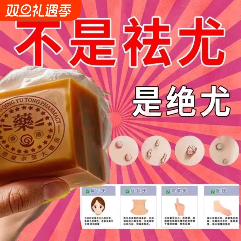 全身手工脖子上长尤疣瘊小肉粒肤康皂专用香港正品药香皂草本植物