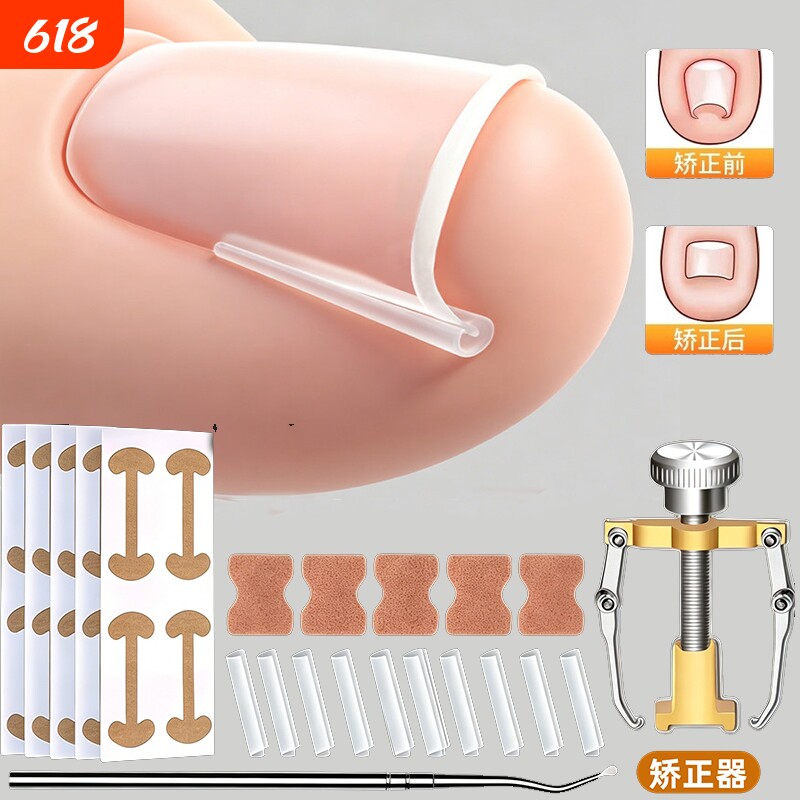 甲沟矫正器指甲扎肉嵌甲专用防脚指甲往肉里长专用隔离工具填充垫