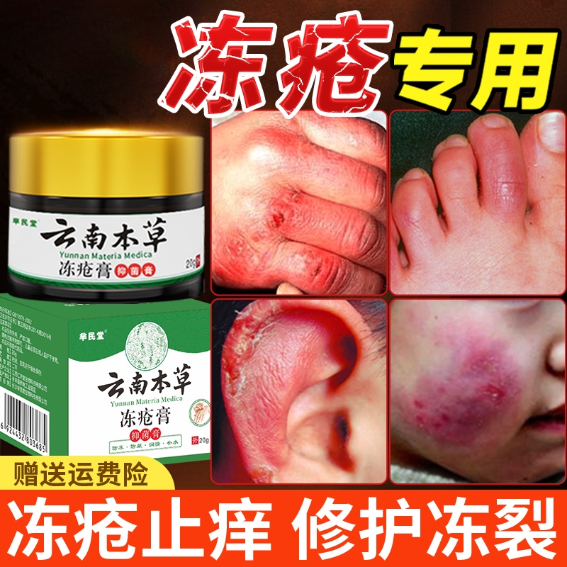 冻疮膏止痒冻伤膏防裂冻正品耳朵脸部消肿儿童冻手神器防冻霜修复