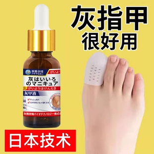 灰指甲专用抑菌液发黄增变厚变硬修剪刀冰醋酸涂剂趾膏正品 旗舰店