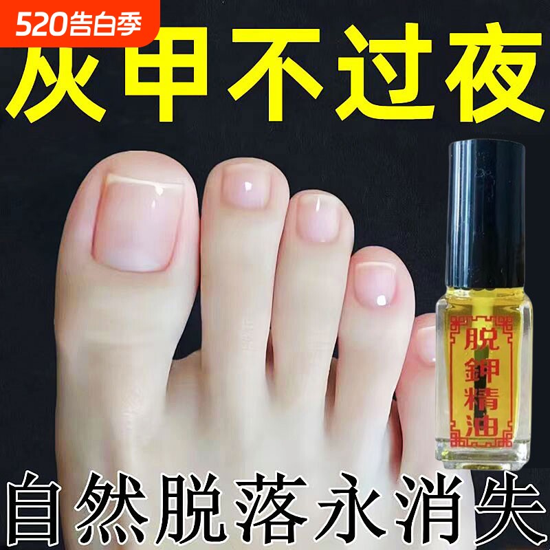 简单2步正品新亮甲灰指甲专用修护手脚重度甲沟炎抑菌液精油植物