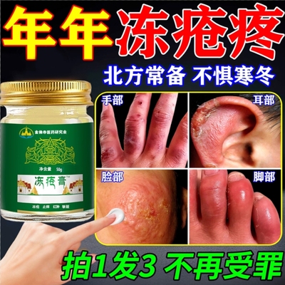 本草冻疮膏手足脚足耳朵足底干裂止痒修复膏护防冻皲裂医用冻伤膏
