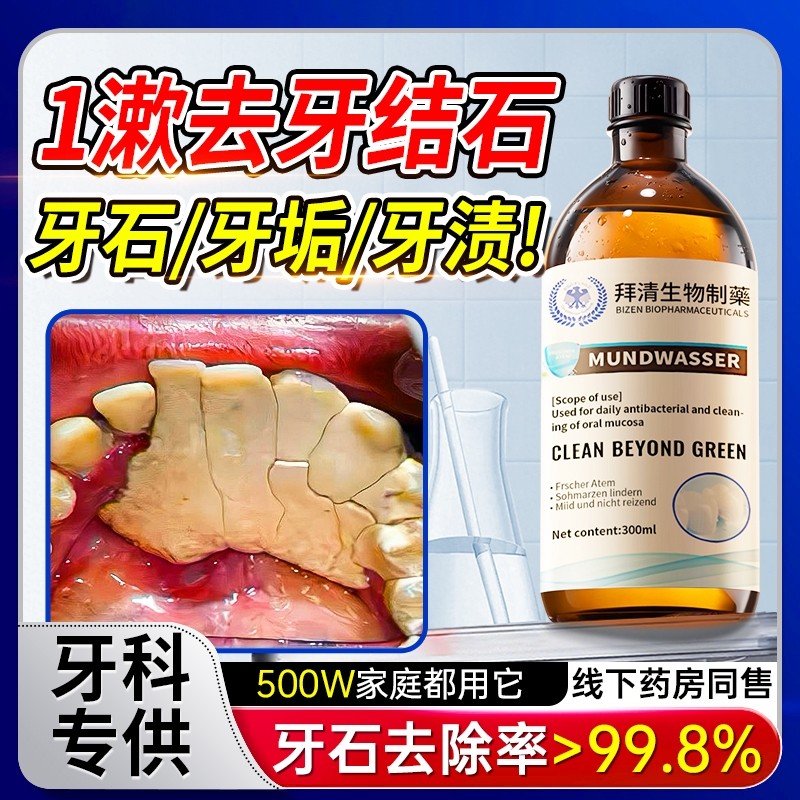 【商超爆款断货王】牙石溶解漱口水洗牙齿污垢牙垢黄牙渍清理神器