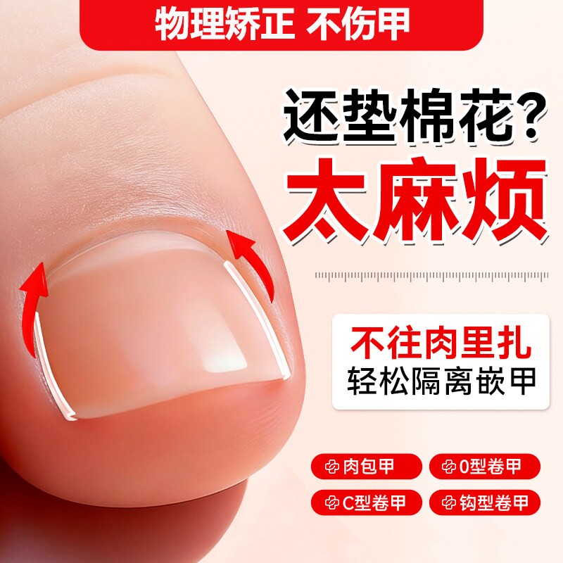 甲沟矫正器填充垫趾甲炎嵌甲修脚套装正甲专用脚趾甲往肉里长神器