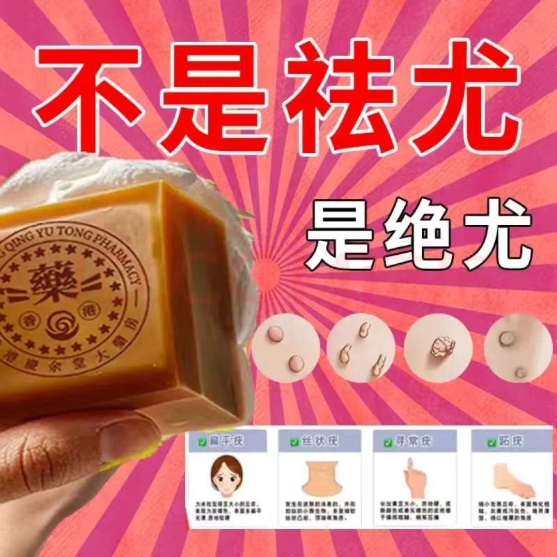 【香港正品】脖子上长祛去尤疣瘊小肉粒肤康皂专用全身手工药香皂