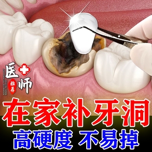 补牙神器自己在家补牙进口树脂材料填充牙齿缝牙洞专用永久修补膏