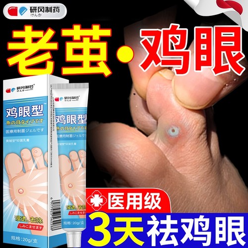 去除鸡眼扁平疣药膏|118人收藏
