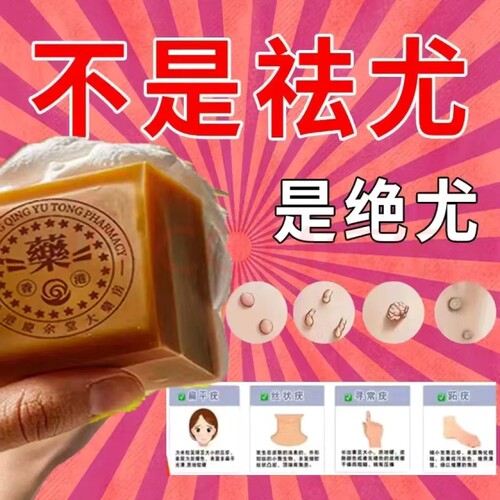 香港正品脖子长肉粒祛尤瘊肤康皂