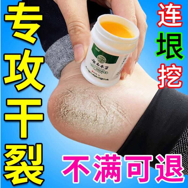 专治脚裂脚后跟干裂起硬皮足跟开裂真菌防皲裂脱皮修复霜药膏脚跟