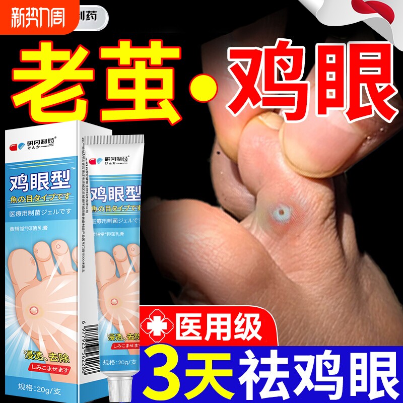 医用鸡眼膏鸡贴眼膏去除扁平疣跖疣疣老茧肉刺粒脚底足部药膏神器