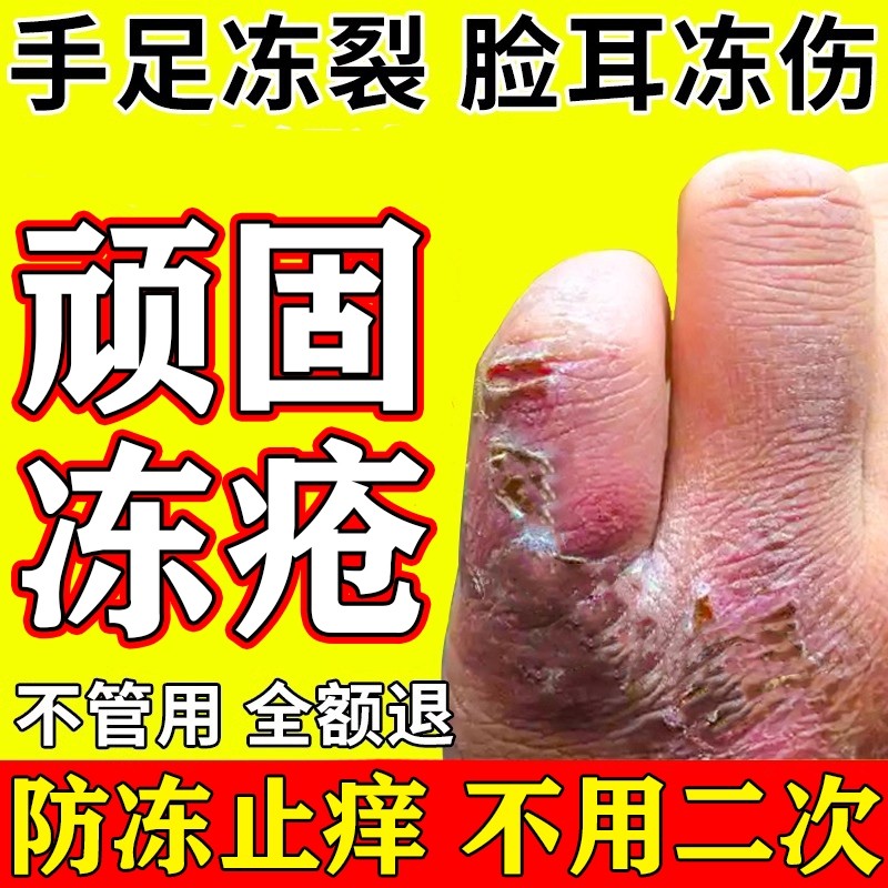冻疮膏止痒冻伤膏正品排行榜第一名防足裂手指裂口干皴裂修复膏M,保健用品,皮肤消毒护理（消）,淘宝优惠券,粉丝福利购,淘宝优惠卷