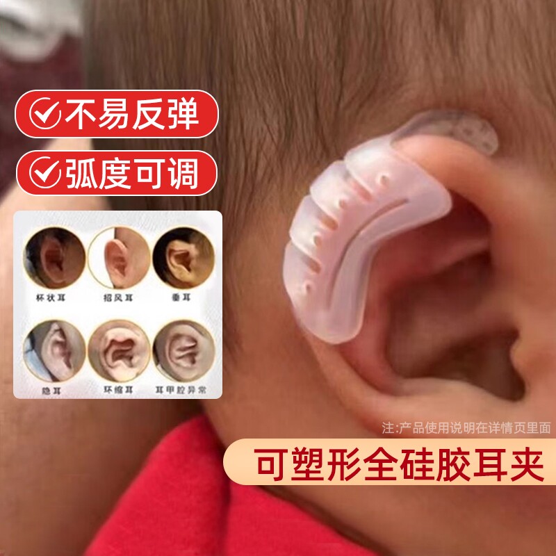 婴儿耳廓矫正器宝宝耳朵定型贴垂耳耳夹新生儿硅胶招风耳耳撑纠正