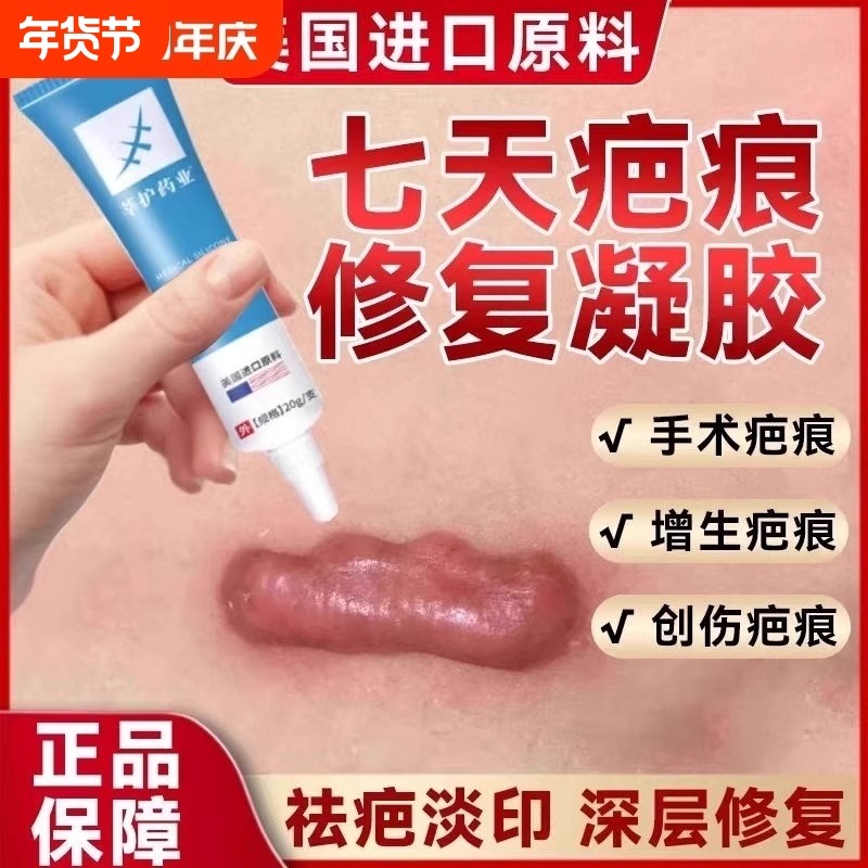 疤克祛疤膏官方旗舰店修复正品增生疤痕硅酮疤痕膏硅凝胶除疤去疤