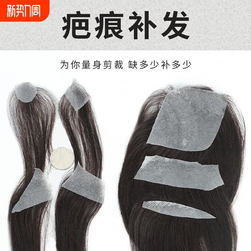 生物皮假发男女发际线假发贴片隐形无痕小面积疤痕斑秃头顶补发片