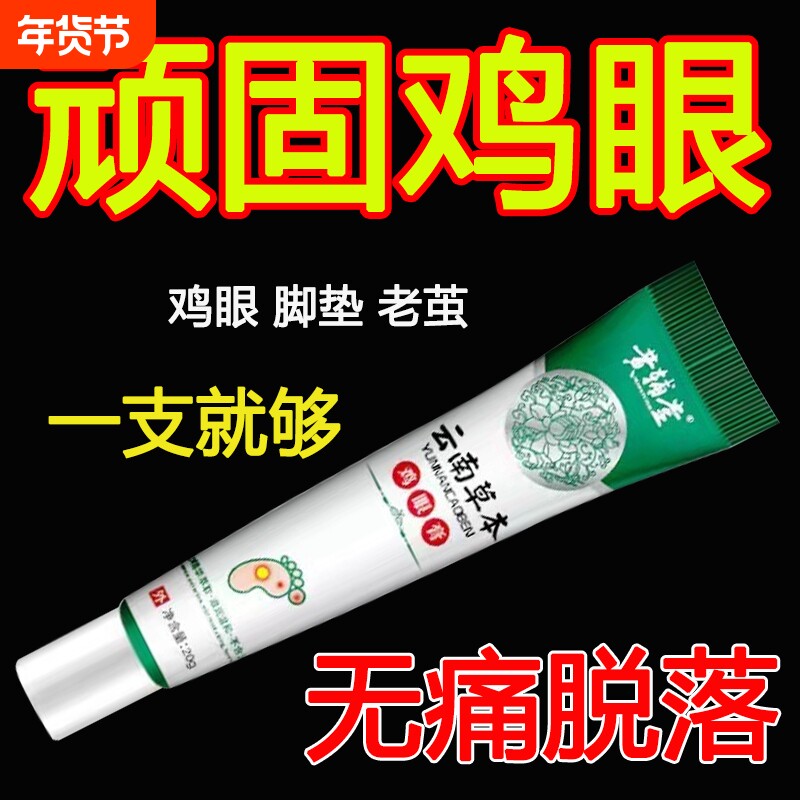鸡眼膏鸡眼膏贴跖老祛茧肉刺脚趾鸡眼软膏官方正品鸡眼膏