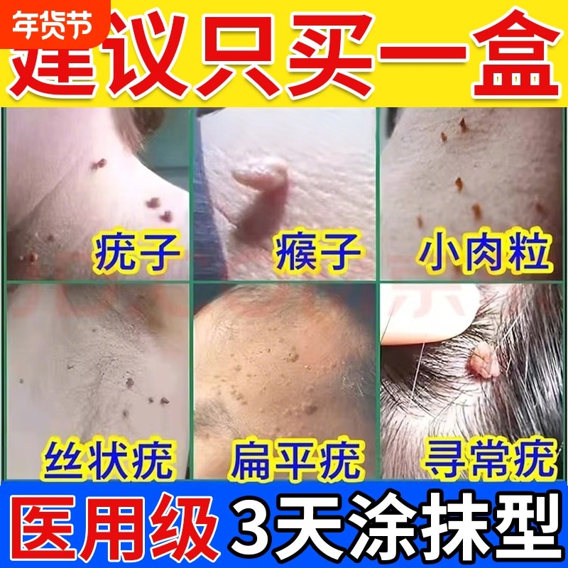 正品克优膏去除疣瘊肉粒云南本草扁平专用丝状神器疣官方旗舰店,保健用品,皮肤消毒护理（消）,淘宝优惠券,粉丝福利购,淘宝优惠卷