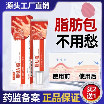 葆元皮肤纤维瘤膏特肿硬块消瘤去除脂肪制药膏瘤腺囊肿非治疗神器
