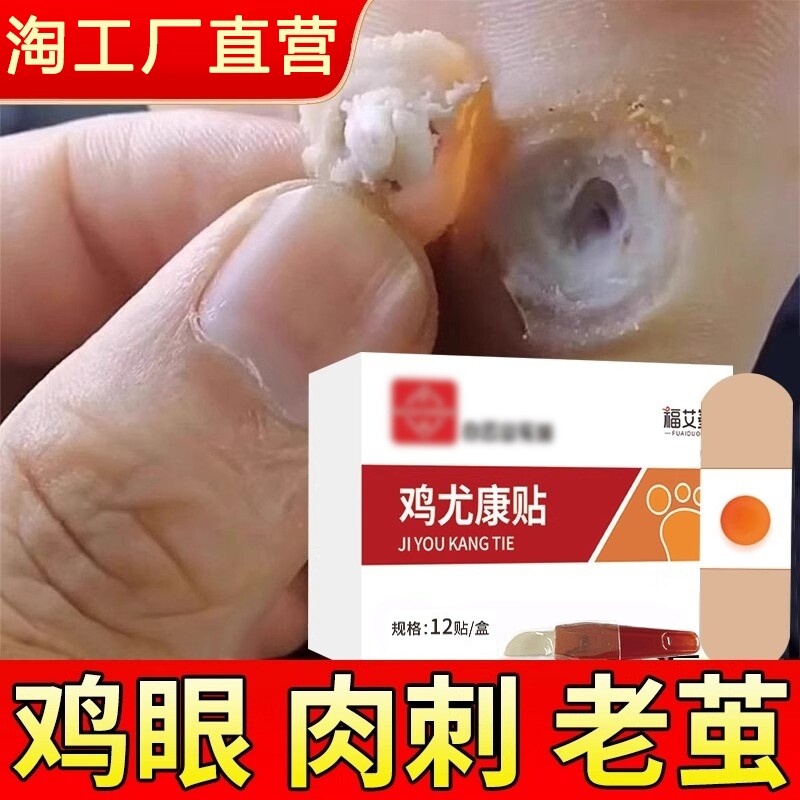 鸡眼贴膏去跖疣除老茧根官方正品旗舰店脚底脚后跟趾根肉刺医用