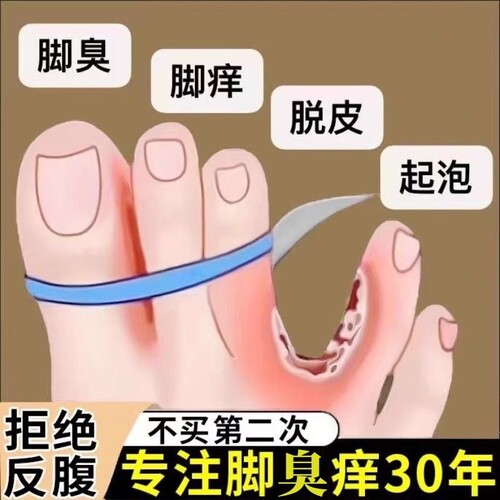 云南本草足部抑菌脚喷气雾剂止痒喷剂官方旗舰店正品植物精华草本