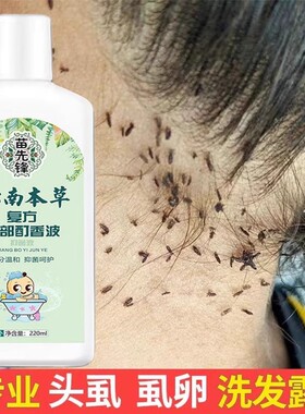 除头虱子的药儿童小孩头上长的药去虱子洗发水洗发香波狮子抑菌