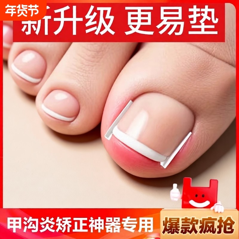 甲沟神器指甲矫正器嵌甲炎专用隔离填充垫片脚趾甲往肉里长甲棉花,家庭/个人清洁工具,美甲/修甲套装,淘宝优惠券,粉丝福利购,淘宝优惠卷