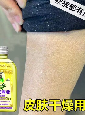 小腿干燥起皮鱼鳞皮肤霜秋冬皮肤干痒儿童护肤甘油身体润肤油止痒