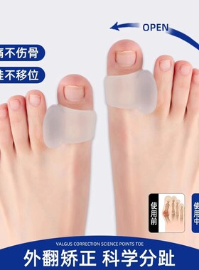 脚趾拇指外翻矫正器分趾器脚趾头足大脚骨可穿鞋矫正神器防磨重叠