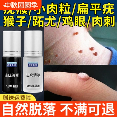 去除尤疣瘊猴子瘊子祛除神器肉粒疙瘩一抹无忧脖子上长小肉粒药膏