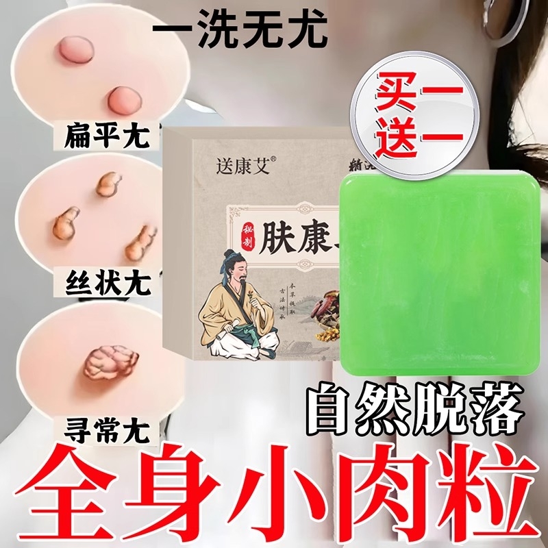 脖子上长祛去尤疣瘊小肉粒草本肤康皂专用克尤皂手工药香皂旗舰店