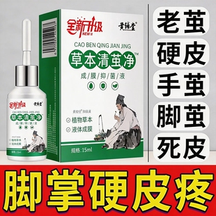去除老茧脚茧软化剂脚钉脚底手脚趾死皮硬皮鸡茧眼祛除膏草本脚垫