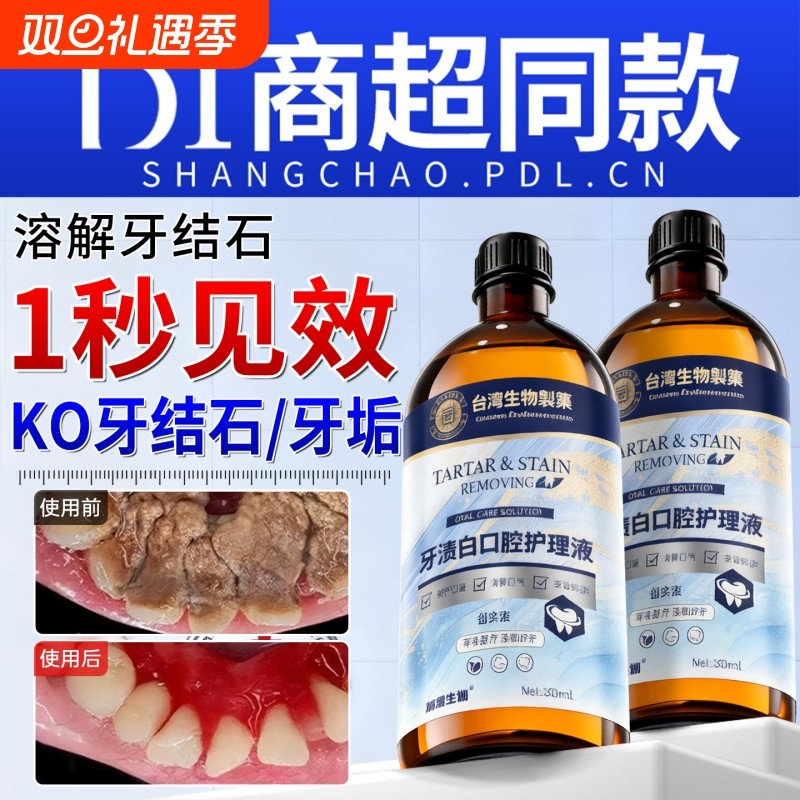 【商超爆款断货王】牙石溶解漱口水洗牙齿污垢牙垢黄牙渍清理神器