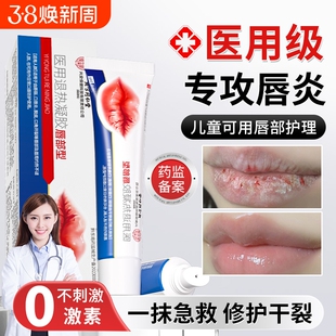 唇炎润唇膏嘴唇干裂脱皮唇膏保湿滋润去死皮口角炎医用修护膏专用