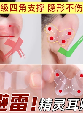 蝴蝶精灵耳贴强支撑女生隐形显脸小固定招风耳矫正器立耳定型神器