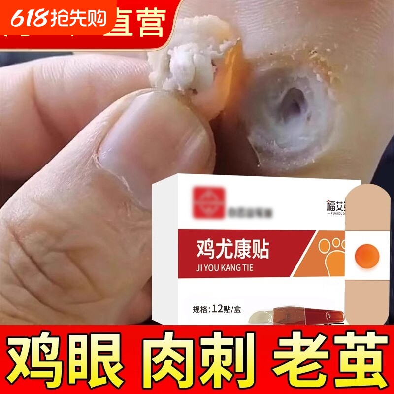 鸡眼贴膏去跖疣除老茧根官方正品旗舰店脚底脚后跟趾根肉刺医用
