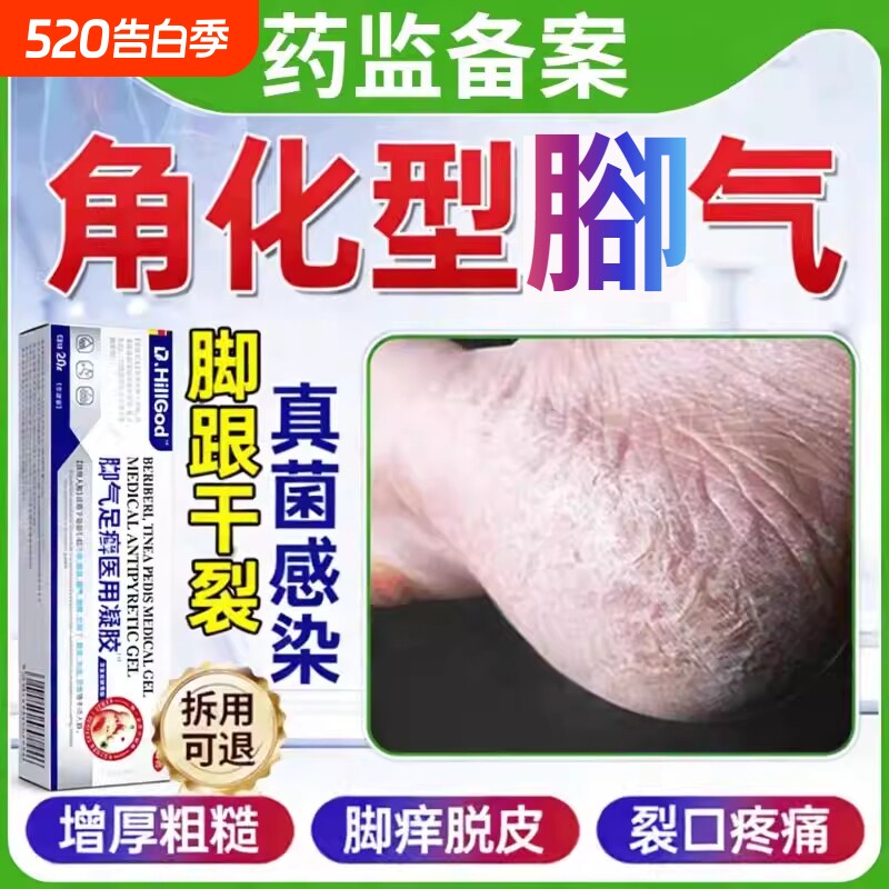 腳后跟干裂真菌感染角化型腳气止痒脱皮杀菌真菌感染官方正品