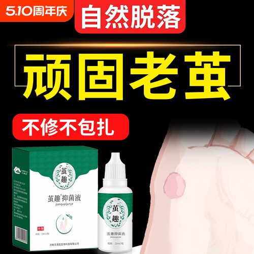 专攻老茧鸡茧【自然脱落】软化剂