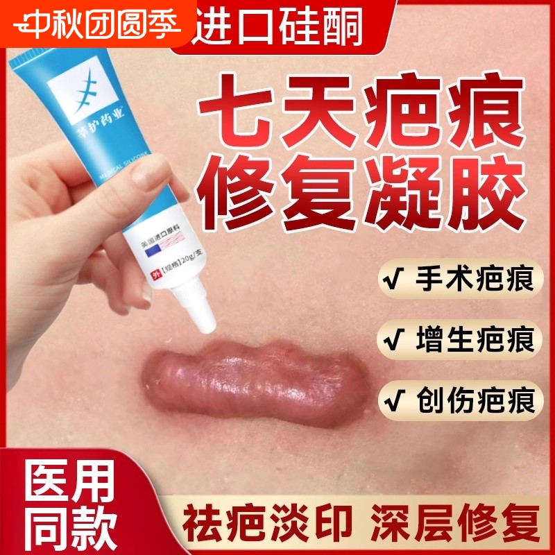 祛疤膏去疤膏除疤痕增生凸起去除疙瘩修复手术剖腹产医用硅酮凝胶