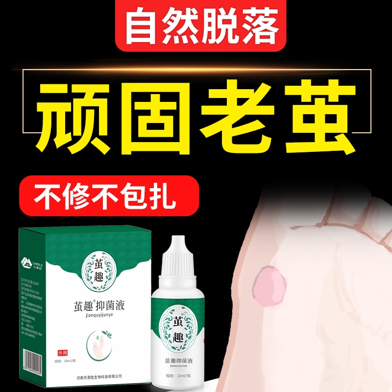 本草去茧软化剂|超4000次加购