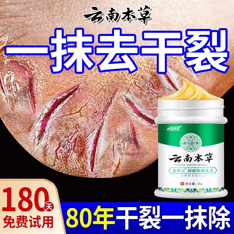 去脚后跟老茧死皮软化剂死皮膏专脚裂脚后跟干裂起硬皮足跟开裂