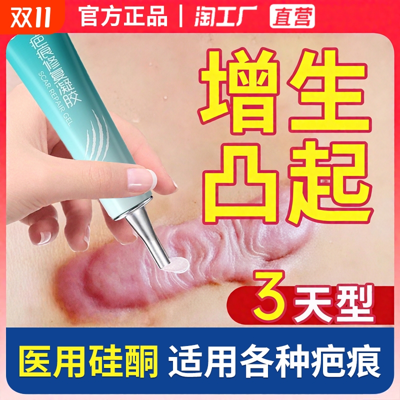 【销量NO.I】医用硅酮凝胶祛疤膏