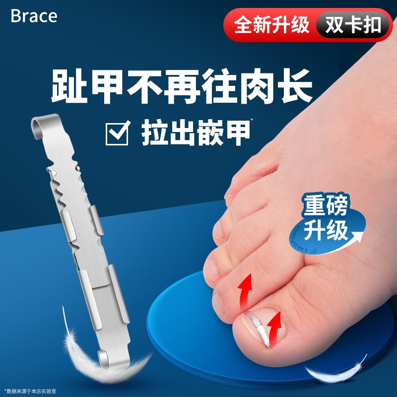 正甲扣甲沟矫正器脚趾甲卷指甲长肉里纠正器炎嵌甲神器工具修脚刀