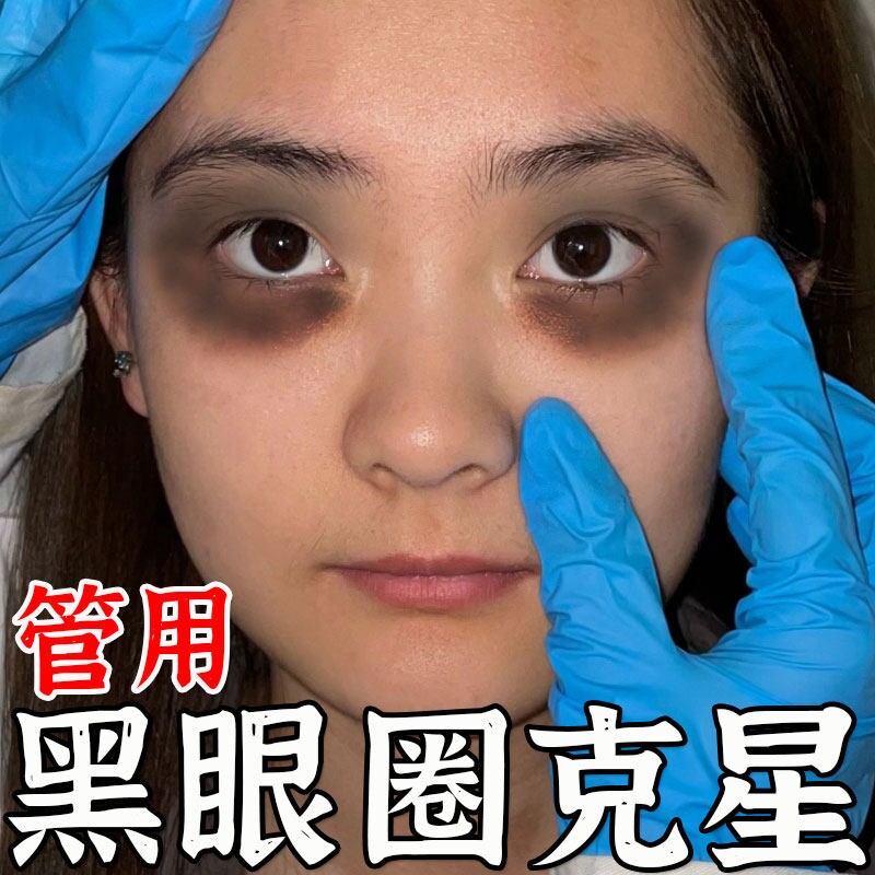 黑眼圈去除神器男女士视失眠疲劳特别严重熊猫眼罩艾草蒸汽热敷贴