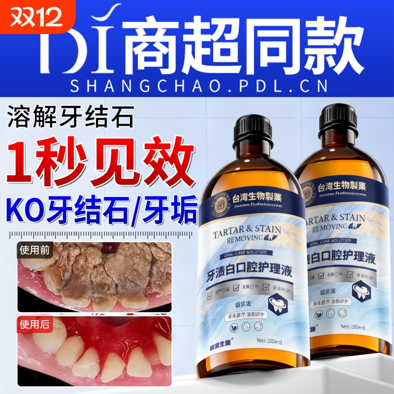 【商超爆款断货王】牙石溶解漱口水洗牙齿污垢牙垢黄牙渍清理神器