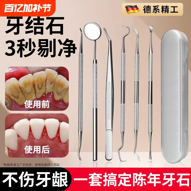 牙结石去除器牙齿清洁口腔镜子剔牙神器去污垢工具专用洁牙科家用