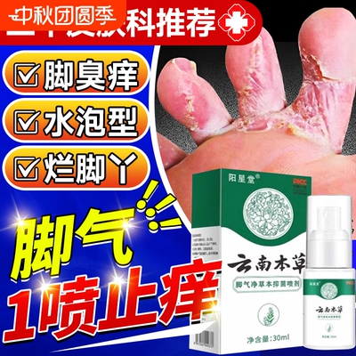 云南本草脚气喷雾|超3000次加购